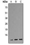 Apolipoprotein C3 antibody, MBS8224218, MyBioSource, Western Blot image 