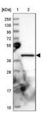 GIPC PDZ Domain Containing Family Member 1 antibody, NBP1-91941, Novus Biologicals, Western Blot image 