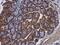 Calpain 2 antibody, NBP2-15676, Novus Biologicals, Immunohistochemistry paraffin image 