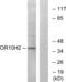 Olfactory Receptor Family 10 Subfamily H Member 2 antibody, abx015398, Abbexa, Western Blot image 