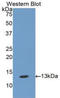 Mucin 5B, Oligomeric Mucus/Gel-Forming antibody, LS-C304565, Lifespan Biosciences, Western Blot image 