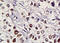 Zinc Finger And BTB Domain Containing 7A antibody, 250828, Abbiotec, Immunohistochemistry paraffin image 