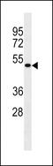 Multiciliate Differentiation And DNA Synthesis Associated Cell Cycle Protein antibody, GTX53649, GeneTex, Western Blot image 