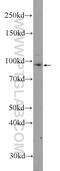 USBP1 antibody, 17226-1-AP, Proteintech Group, Western Blot image 