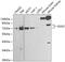 Golgi Associated, Gamma Adaptin Ear Containing, ARF Binding Protein 2 antibody, GTX55637, GeneTex, Western Blot image 