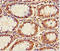 Coiled-Coil Domain Containing 59 antibody, A67766-100, Epigentek, Immunohistochemistry paraffin image 