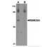 Epithelial Splicing Regulatory Protein 1 antibody, NBP1-76536, Novus Biologicals, Western Blot image 