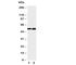Nuclear Factor Kappa B Subunit 2 antibody, R31047, NSJ Bioreagents, Western Blot image 