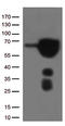 Estrogen Receptor 1 antibody, LS-C791157, Lifespan Biosciences, Western Blot image 