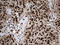 ASH2 Like, Histone Lysine Methyltransferase Complex Subunit antibody, LS-C792626, Lifespan Biosciences, Immunohistochemistry paraffin image 