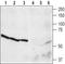 Neuropeptide Y Receptor Y4 antibody, TA328898, Origene, Western Blot image 