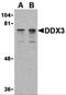 DEAD-Box Helicase 3 X-Linked antibody, 3757, ProSci, Western Blot image 