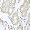 Acyl-CoA Dehydrogenase Family Member 9 antibody, PA5-76270, Invitrogen Antibodies, Immunohistochemistry paraffin image 