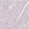 CD3 antibody, AMAb90876, Atlas Antibodies, Immunohistochemistry paraffin image 