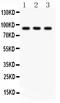 CCCTC-Binding Factor antibody, PB9493, Boster Biological Technology, Western Blot image 