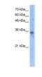 Solute Carrier Family 25 Member 16 antibody, NBP1-59587, Novus Biologicals, Western Blot image 