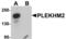 Pleckstrin Homology And RUN Domain Containing M2 antibody, TA306874, Origene, Western Blot image 