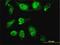 Homeobox D11 antibody, H00003237-M10, Novus Biologicals, Immunofluorescence image 