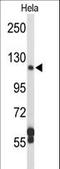 Dipeptidyl Peptidase 8 antibody, LS-C167519, Lifespan Biosciences, Western Blot image 