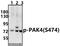 P21 (RAC1) Activated Kinase 4 antibody, A01723S474, Boster Biological Technology, Western Blot image 