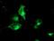 Tubulin Folding Cofactor C antibody, NBP2-02037, Novus Biologicals, Immunofluorescence image 