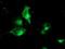 Tubulin-specific chaperone C antibody, NBP2-02037, Novus Biologicals, Immunofluorescence image 