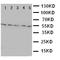 Hyaluronidase 2 antibody, orb76330, Biorbyt, Western Blot image 