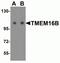 Anoctamin 2 antibody, NBP2-81703, Novus Biologicals, Western Blot image 