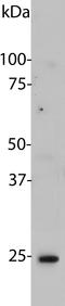 High Mobility Group Box 1 antibody, LS-C204528, Lifespan Biosciences, Western Blot image 