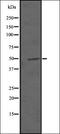 Myocardin Related Transcription Factor B antibody, orb337681, Biorbyt, Western Blot image 