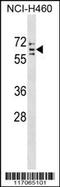 Cytochrome P450 Family 4 Subfamily V Member 2 antibody, 59-271, ProSci, Western Blot image 
