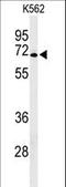 Melatonin-related receptor antibody, LS-C166638, Lifespan Biosciences, Western Blot image 