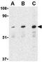 P21 (RAC1) Activated Kinase 6 antibody, GTX31672, GeneTex, Western Blot image 