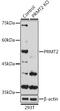 Protein Arginine Methyltransferase 2 antibody, GTX33427, GeneTex, Western Blot image 