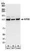 Kinesin Family Member 5B antibody, A304-307A, Bethyl Labs, Western Blot image 