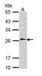 RAN, Member RAS Oncogene Family antibody, GTX114139, GeneTex, Western Blot image 