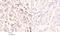 Inositol Hexakisphosphate Kinase 2 antibody, A08792-1, Boster Biological Technology, Immunohistochemistry frozen image 
