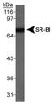 Scavenger Receptor Class B Member 1 antibody, NB400-113, Novus Biologicals, Western Blot image 