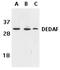 RING1 And YY1 Binding Protein antibody, GTX25976, GeneTex, Western Blot image 