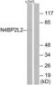 NEDD4 Binding Protein 2 Like 2 antibody, LS-C120220, Lifespan Biosciences, Western Blot image 