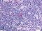 C-X-C chemokine receptor type 5 antibody, LS-A1384, Lifespan Biosciences, Immunohistochemistry paraffin image 