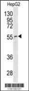 Nucleoporin 62 antibody, MBS9211568, MyBioSource, Western Blot image 
