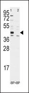 Aldehyde Dehydrogenase 1 Family Member A3 antibody, LS-B15686, Lifespan Biosciences, Western Blot image 