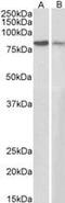 Junction Plakoglobin antibody, MBS420515, MyBioSource, Western Blot image 