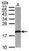 V-Set Pre-B Cell Surrogate Light Chain 1 antibody, NBP2-20868, Novus Biologicals, Western Blot image 