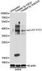 Linker For Activation Of T Cells antibody, LS-C750614, Lifespan Biosciences, Western Blot image 