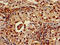 Replication Protein A1 antibody, CSB-PA020088LA01HU, Cusabio, Immunohistochemistry paraffin image 