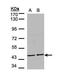 Serine/Threonine Kinase 32B antibody, PA5-28592, Invitrogen Antibodies, Western Blot image 