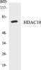Histone Deacetylase 10 antibody, EKC1261, Boster Biological Technology, Western Blot image 
