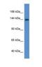 Insulin Receptor antibody, NBP1-74140, Novus Biologicals, Western Blot image 